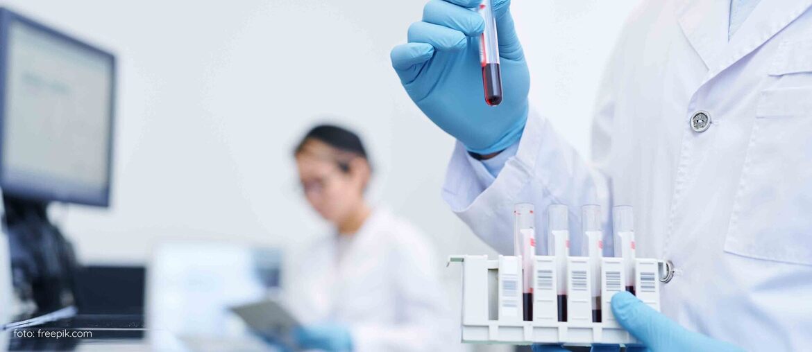 University of Texas zet ontwikkeling bloedtest voort
