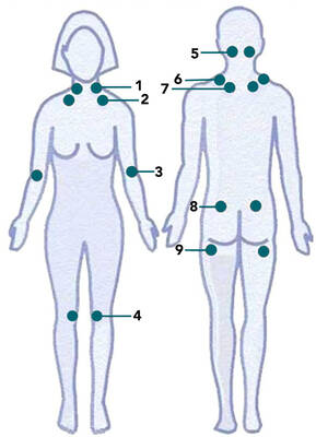 oude methode: tenderpoints